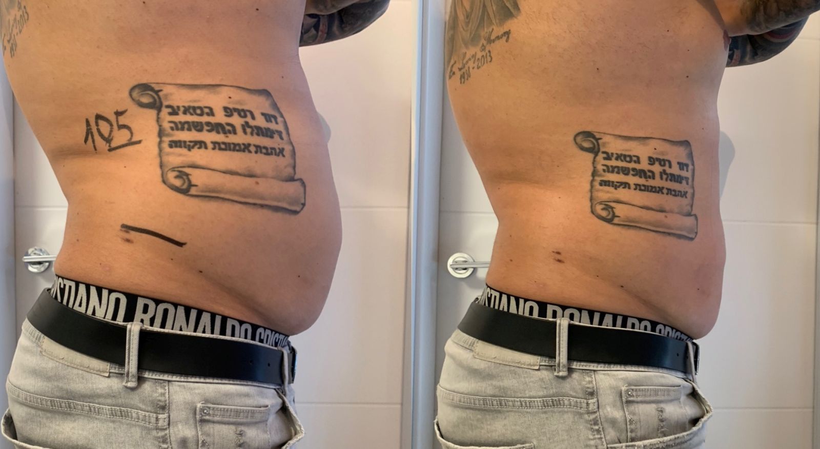 Przykładowy efekt terapii Eximia – modelowanie brzucha i talii